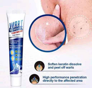 Créme anti verrue