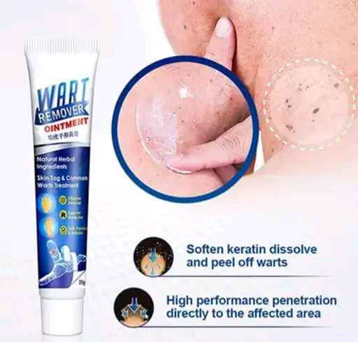 Créme anti verrue